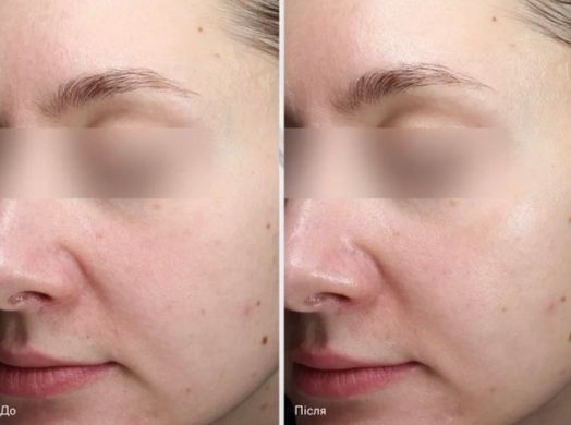 Подушечки з кислотами для глибокого відновлення шкіри Instytutum - Resurfacing Multi-Acids Pads Next-Gen, 60 шт