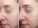 Подушечки з кислотами для глибокого відновлення шкіри Instytutum - Resurfacing Multi-Acids Pads Next-Gen, 60 шт